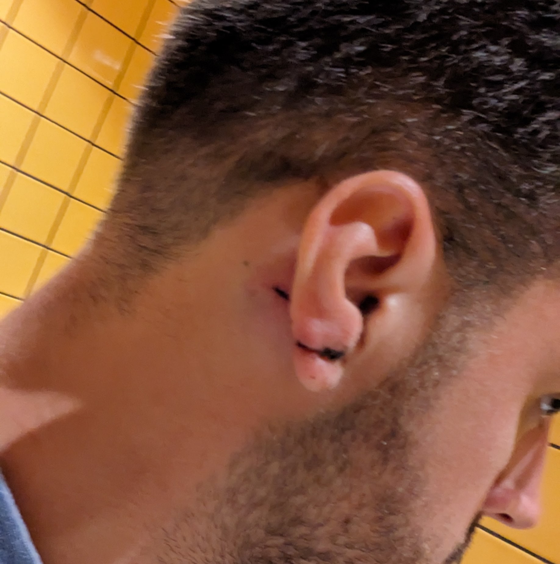Ear sliced through